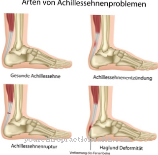 Achilles tendon