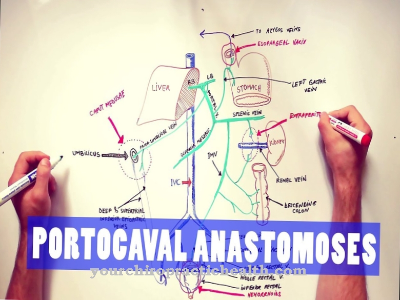 anastomosis