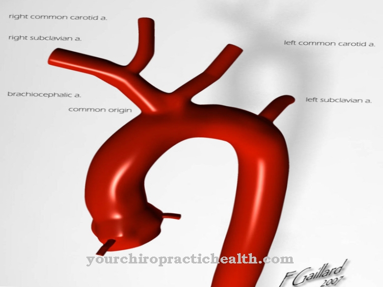 Aortic arch