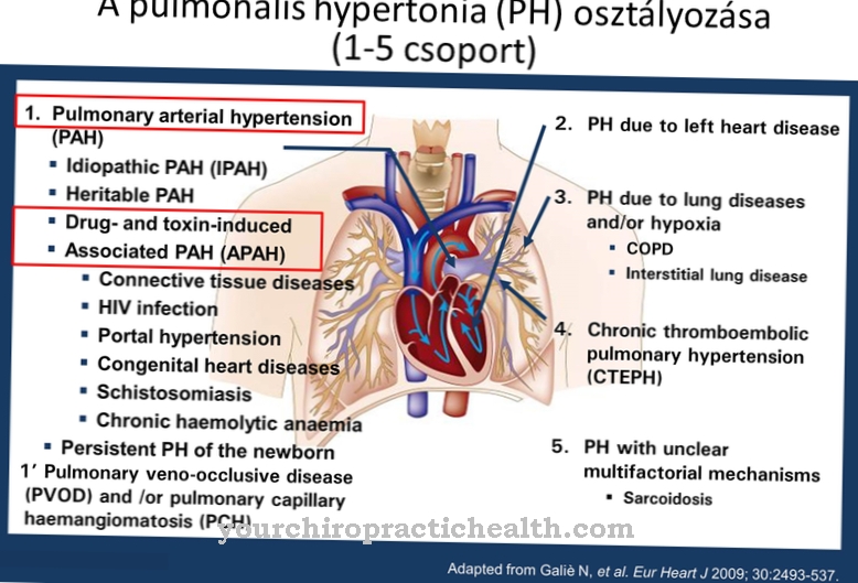 Artéria pulmonar