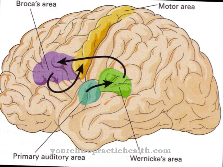 Área de Broca