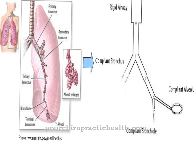 Bronchiolus