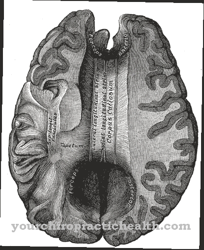 Corpus Callosum