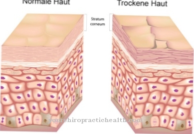 The different skin types