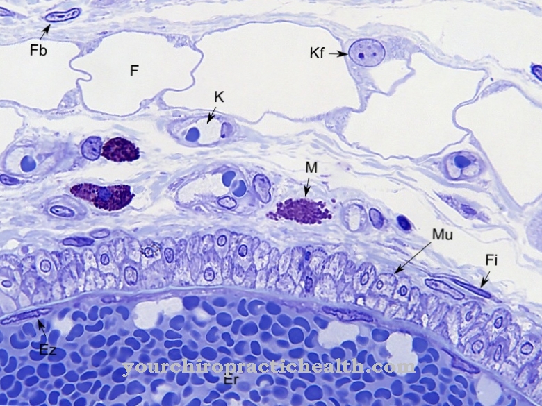 fibrocyte