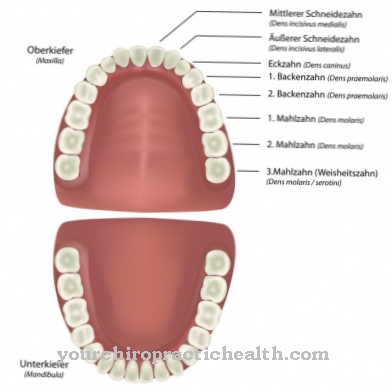 denture