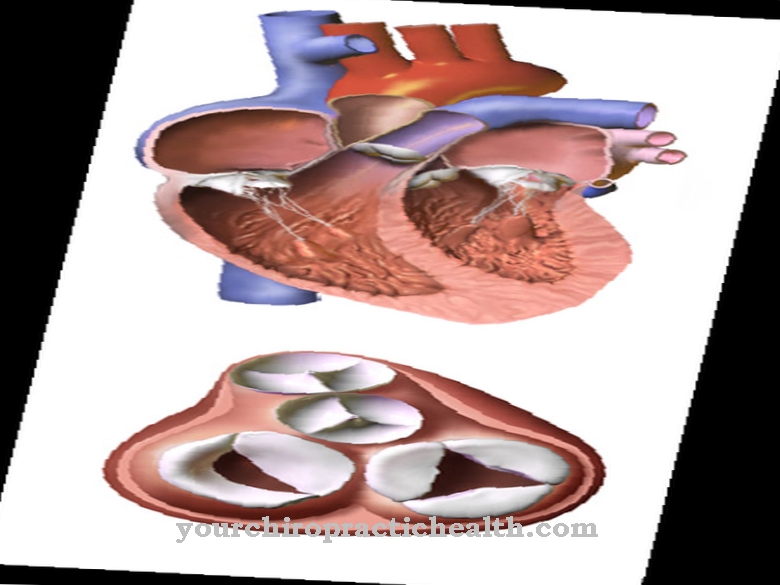 Heart valve