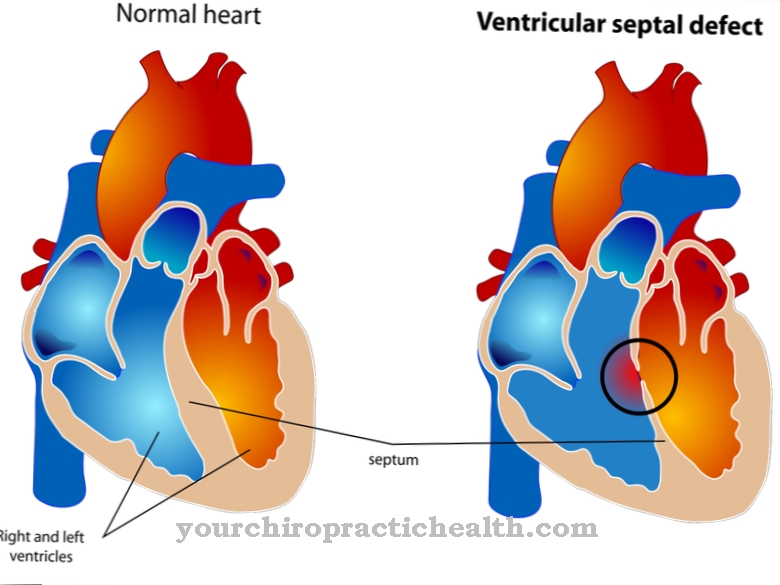 Setto cardiaco