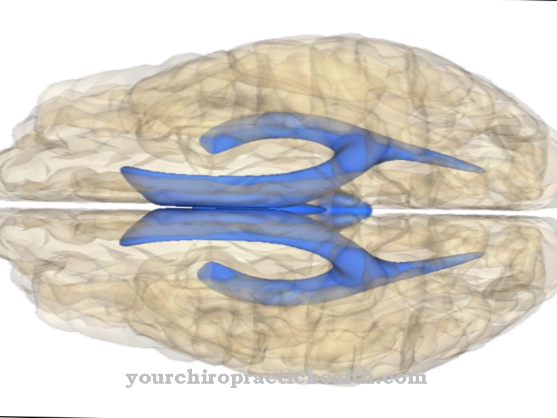 Cerebral ventricle