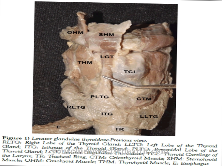 Levator glandulae thyroideae muscle