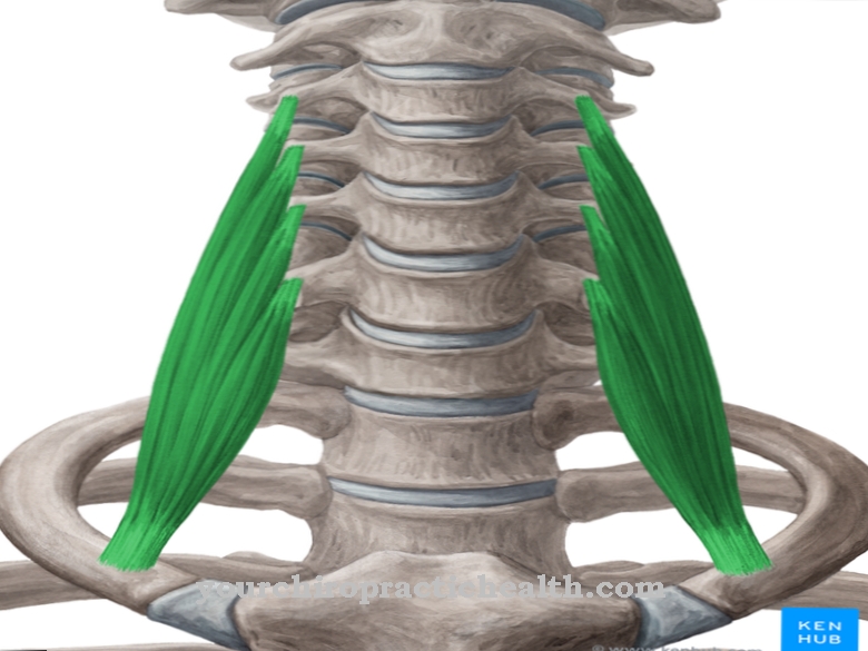 Otot anterior skalenus