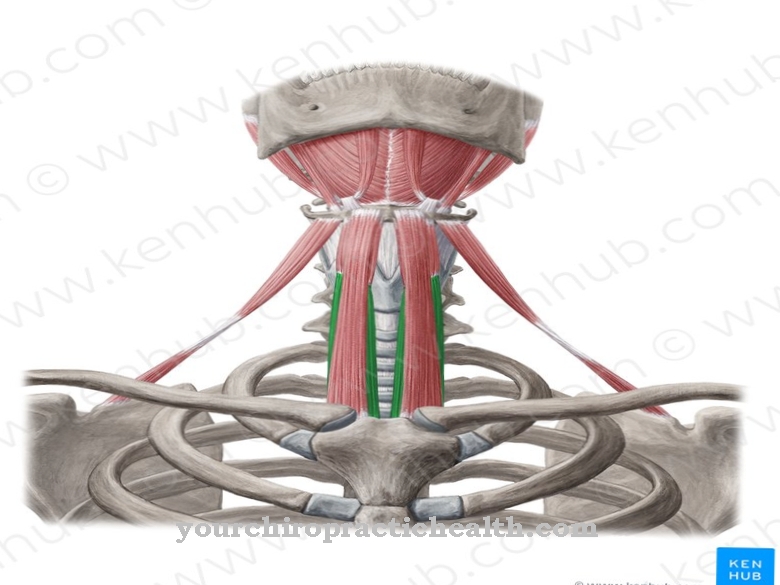 Sternothyroid muskel