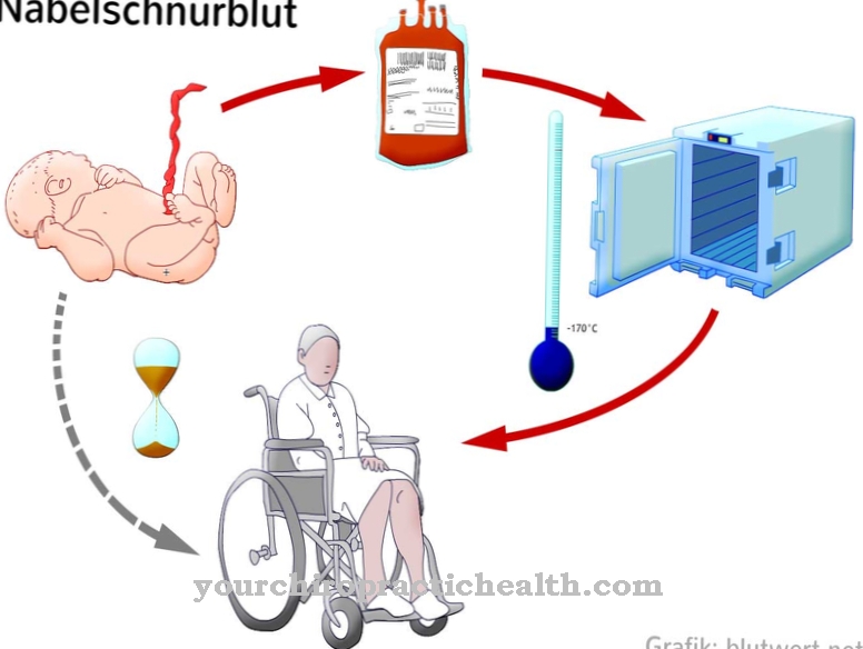 Umbilical cord blood