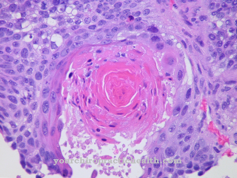 Squamous epithelium