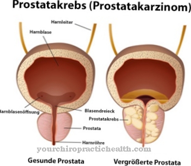 prosztata