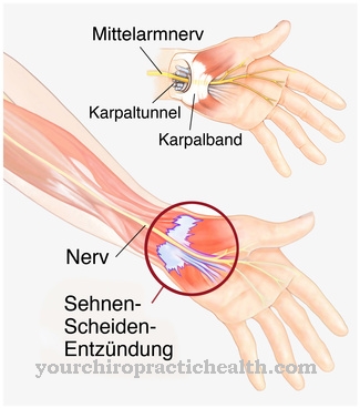 Tendon sheath