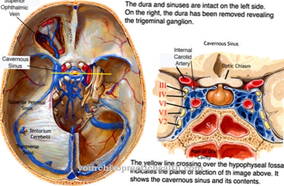 Cavernous sinus