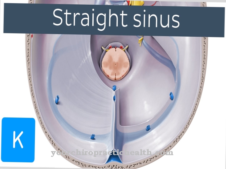 Rectus sinus