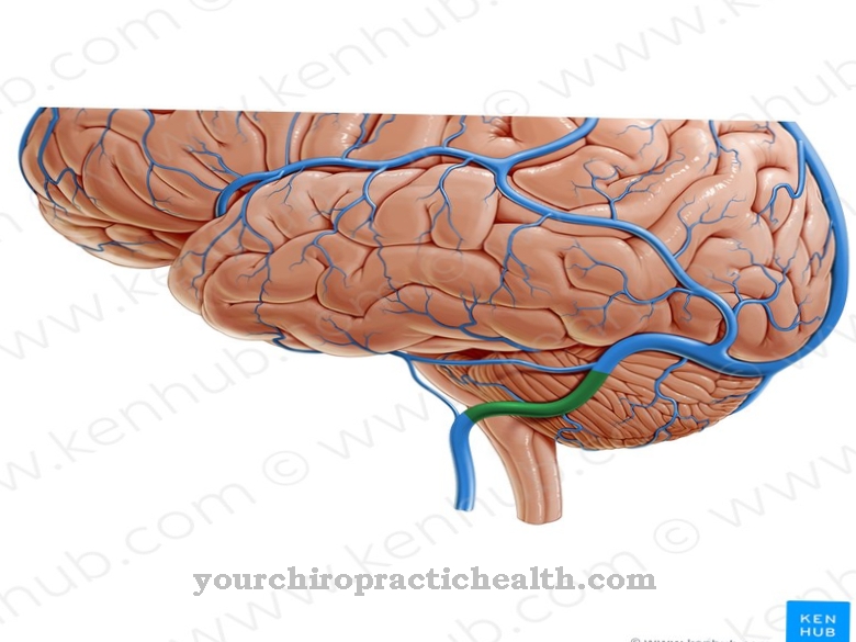 Sigmoid sinus