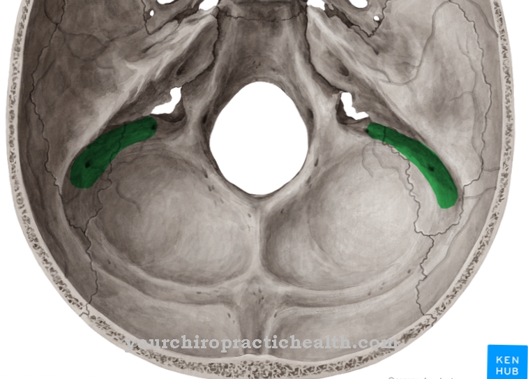 Sulcus sinus sigmoidei