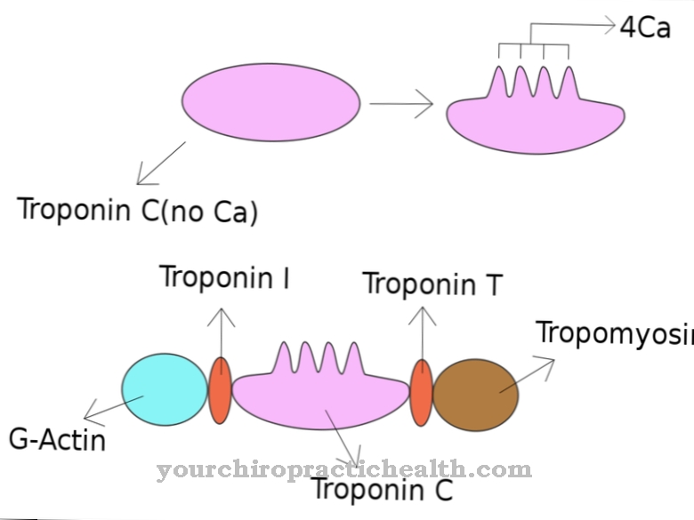 Troponin