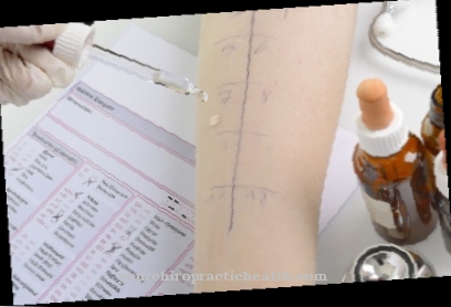 Allergy test