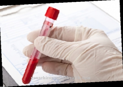 Blood test