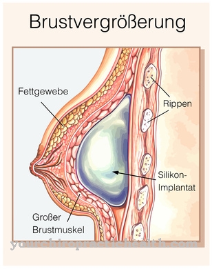 Ingrandimento del seno