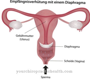 Diaphragm