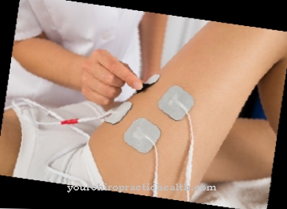 Electrical stimulation