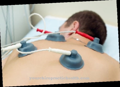 Electrotherapy