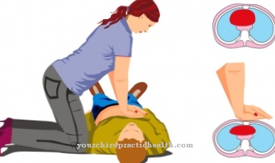 Cardiopulmonary resuscitation