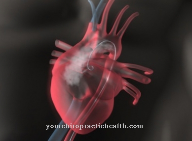 Cardiac catheterization