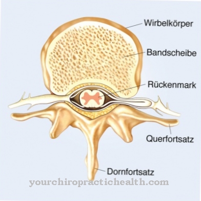 Cerebral fluid examination