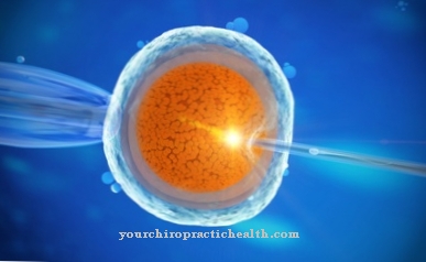 In vitro fertilization