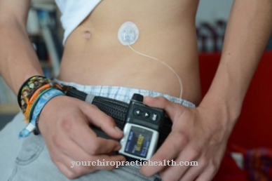 Insulin pump