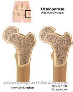 Bone density measurement