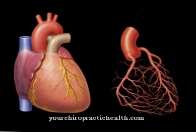 Coronary angiography