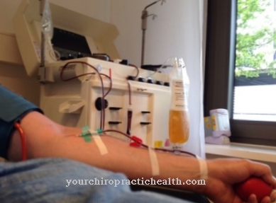 Leukocyte apheresis