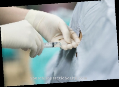 Lumbar puncture