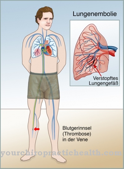 Lung scintigraphy