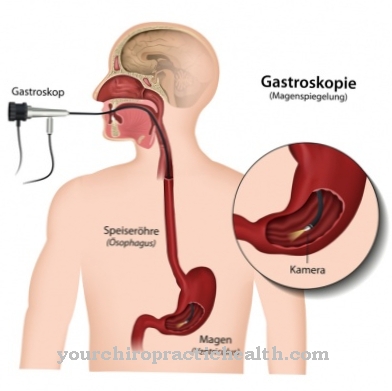 Gastroskopija