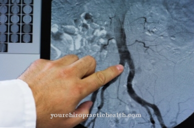 Magnetic resonance angiography