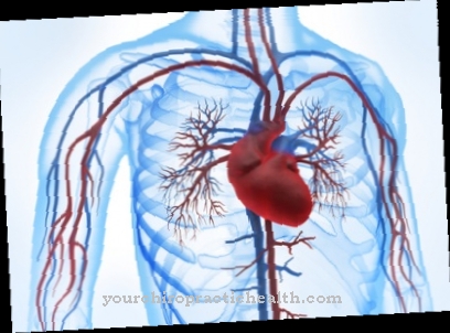 Myocardial scintigraphy