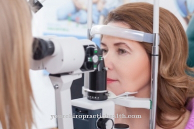 Optical coherence tomography