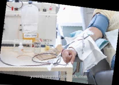 Plasmapheresis