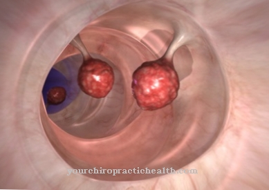 Rectosigmoidoscopy