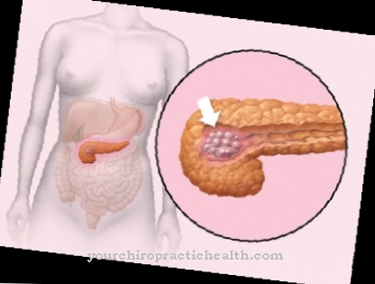 Somatostatin Receptor Scintigraphy