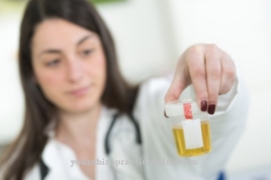 Urinalysis