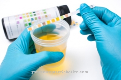 Urine sample